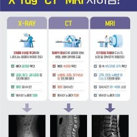 X-ray, CT, MRI의 차이점