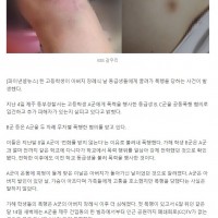 아버지 장례식 날, 불려가 '학폭' 당한 고등학생..'온몸 피멍, 난청까지'.gisa